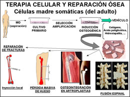 Terapia celular para la regeneración esquelética